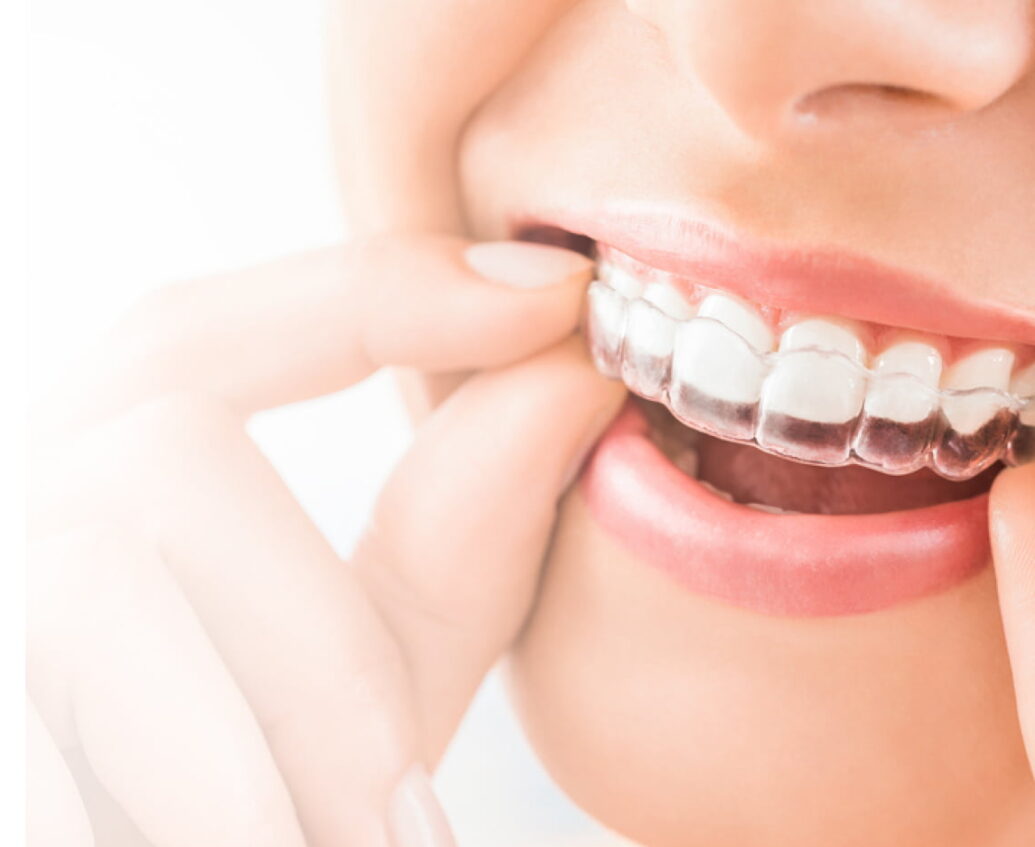 Sutton Dental ClearCorrect