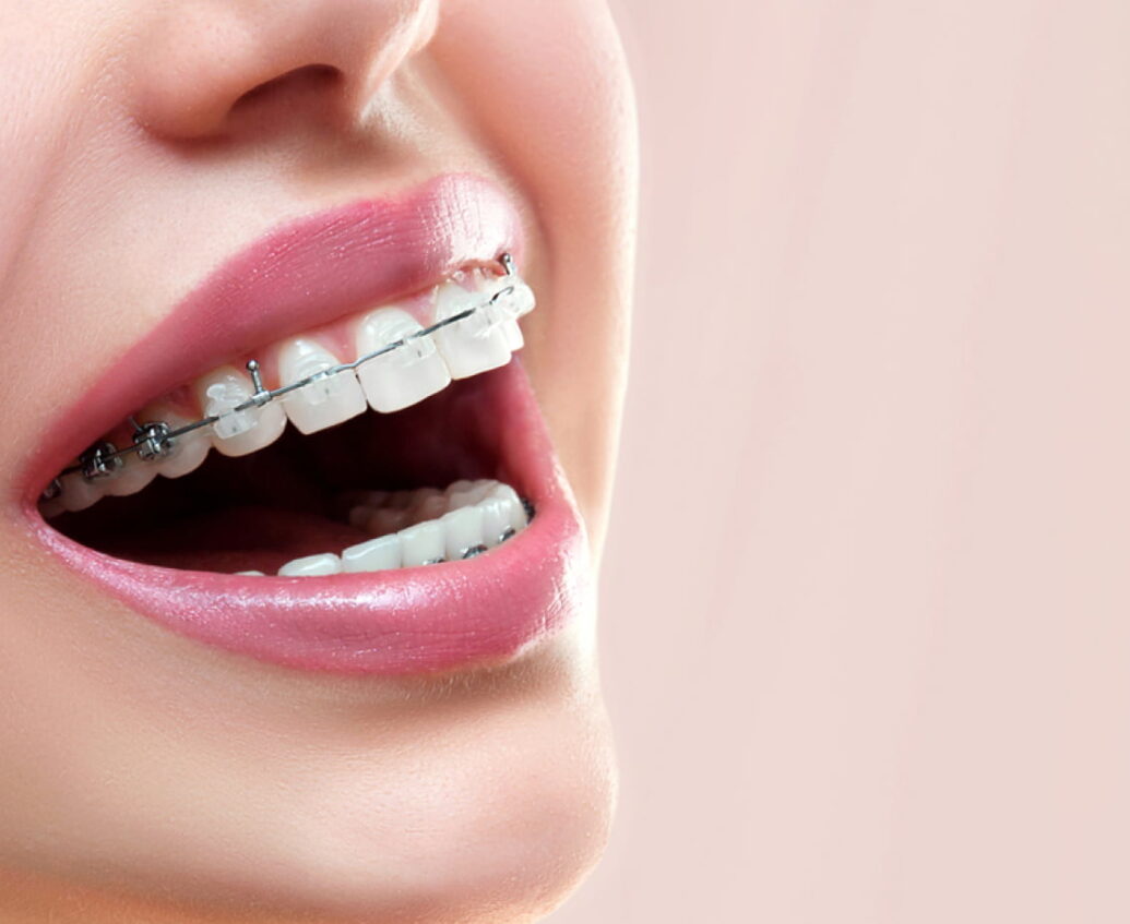Sutton Dental ClearCorrect
