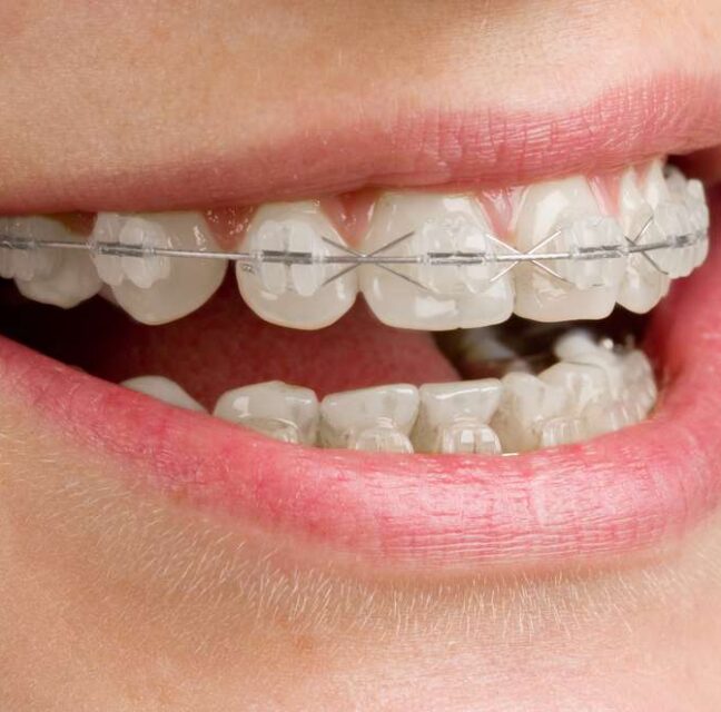 Blog - Sutton Dental & Implant Clinic