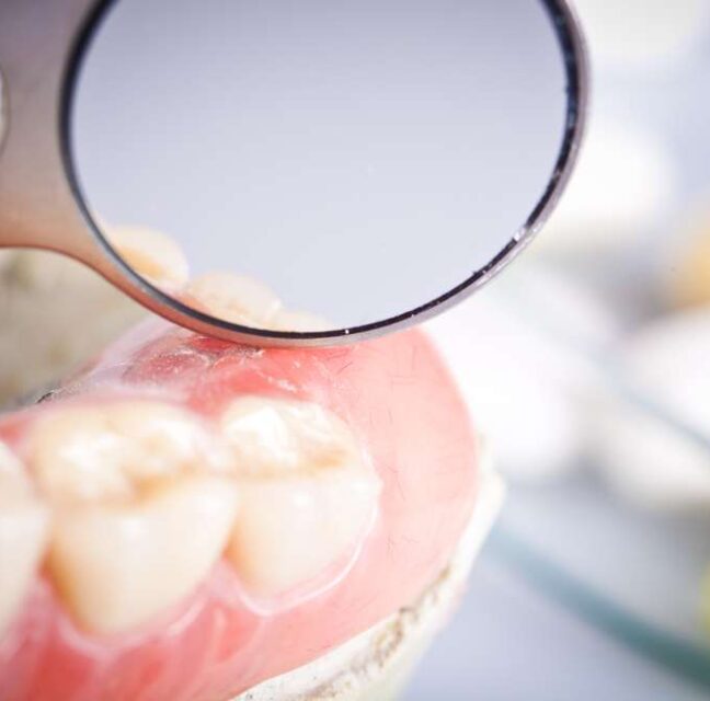 Sutton Dental Tooth Coloured Fillings