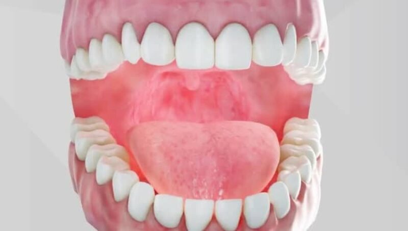 Sutton Dental crown