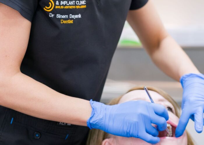 Sutton Dental crown
