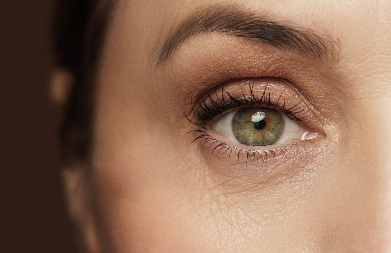 Sutton Dental Clinic Digital Eye Liner