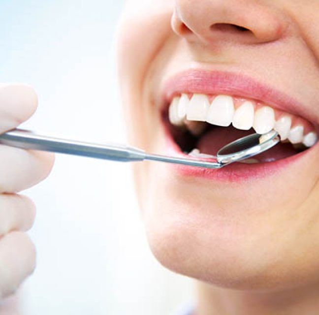 How to Choose Between Multiple Smile Enhancement Options